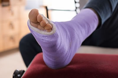 Foot Fractures treatment in the Queens County, NY: Flushing (College Point, Whitestone, Elmhurst, Jackson Heights, Jamaica, Forest Hills, Astoria, Corona), Nassau County, NY: Elmont, Floral Park, Great Neck, Lake Success and Bergen County, NJ: Fort Lee (Englewood, Tenafly, Teaneck, Teterboro, Hackensack, Bergenfield, East Rutherford, Paramus), Hudson County, NJ: Secaucus, Hoboken areas